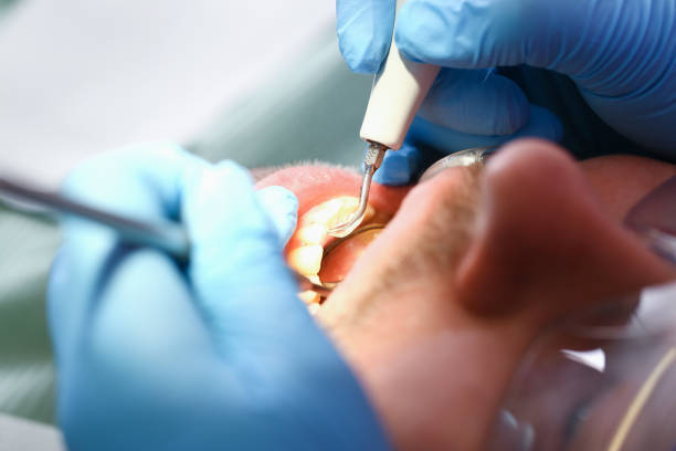 Best Same-Day Emergency Dental Services in Coats Bend, AL