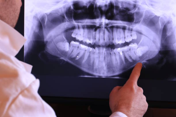 Best Emergency Dental Care for Broken or Chipped Teeth in Coats Bend, AL