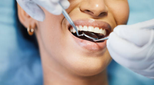 Best Emergency Tooth Extraction in Coats Bend, AL
