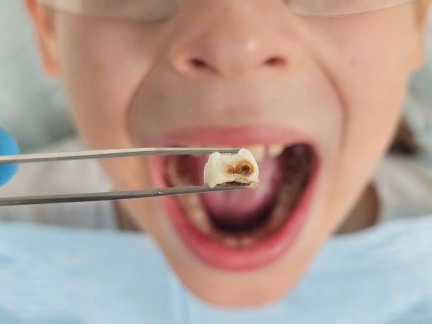 Best Weekend Emergency Dentist in Coats Bend, AL